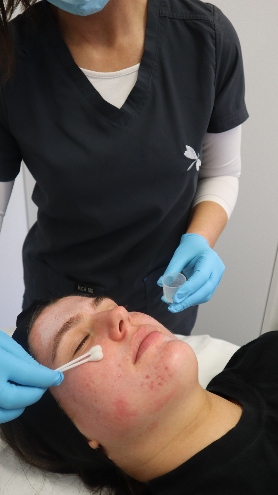Skin Peel General
