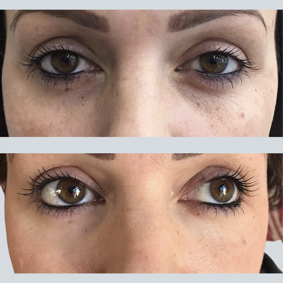 Anti-ageing-eye-General
