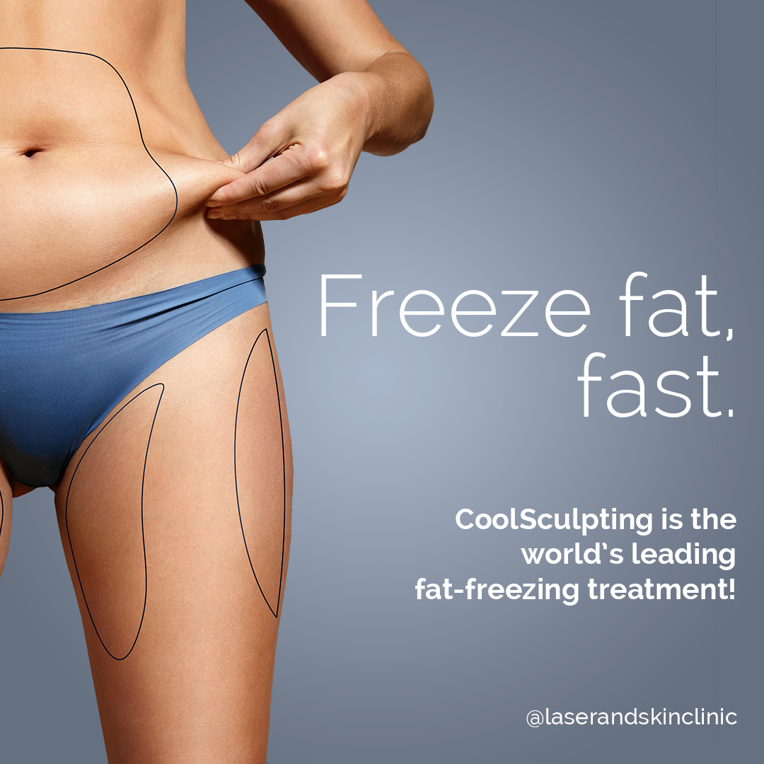 CoolSculpting_General_Picture