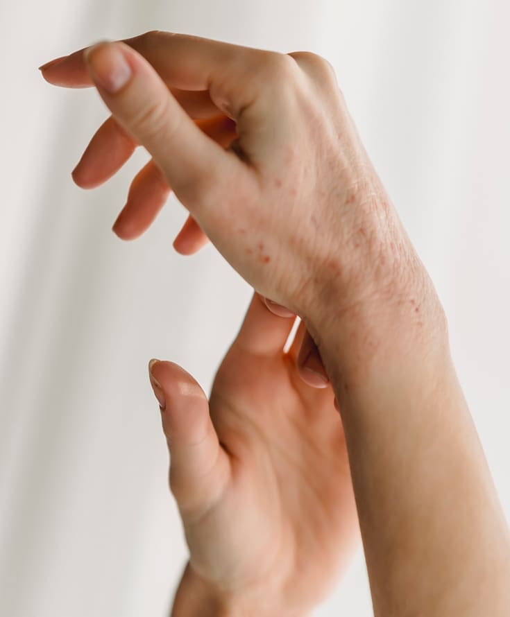 Laser & Skin Clinics - Ageing Hands