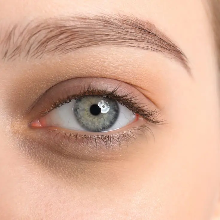 Laser & Skin Clinics - Eye Bags / Dark Circles