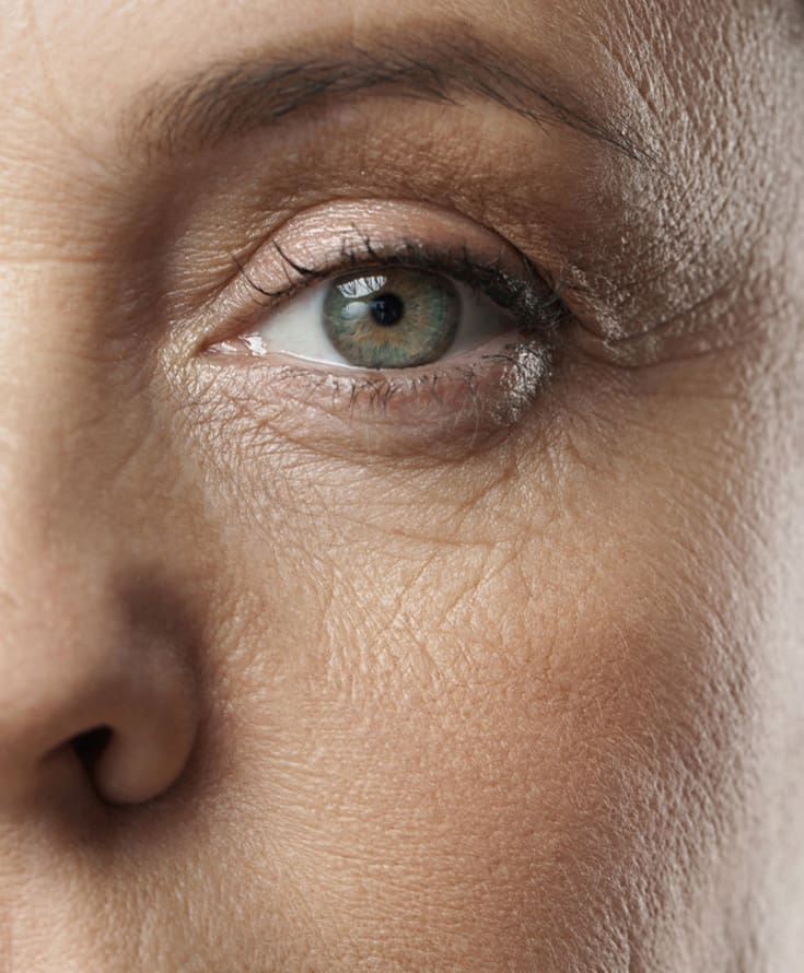 Laser & Skin Clinics - Lines & Wrinkles
