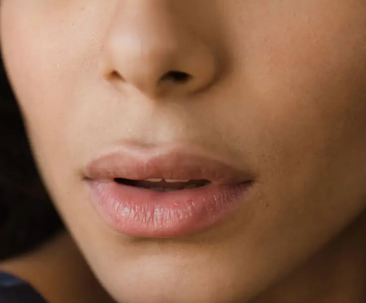 Laser & Skin Clinics - Lip Fillers